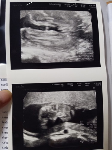 ใครดูเป็นดูให้หน่อยจ้า ญ หรือ ช.จ๊ะ