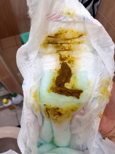 normal poop bo ato sa nangingipin na baby.