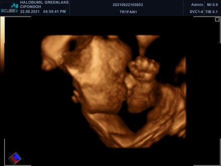 Trifani Juli Mulya profile icon