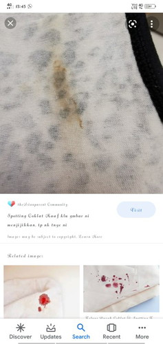 Spotting warna coklat