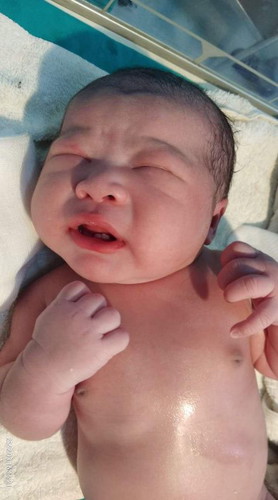 ฟันลูกซี่แรกจะขึ้นตอนไหนคะ