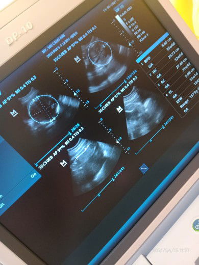 Scahyani 18 profile icon