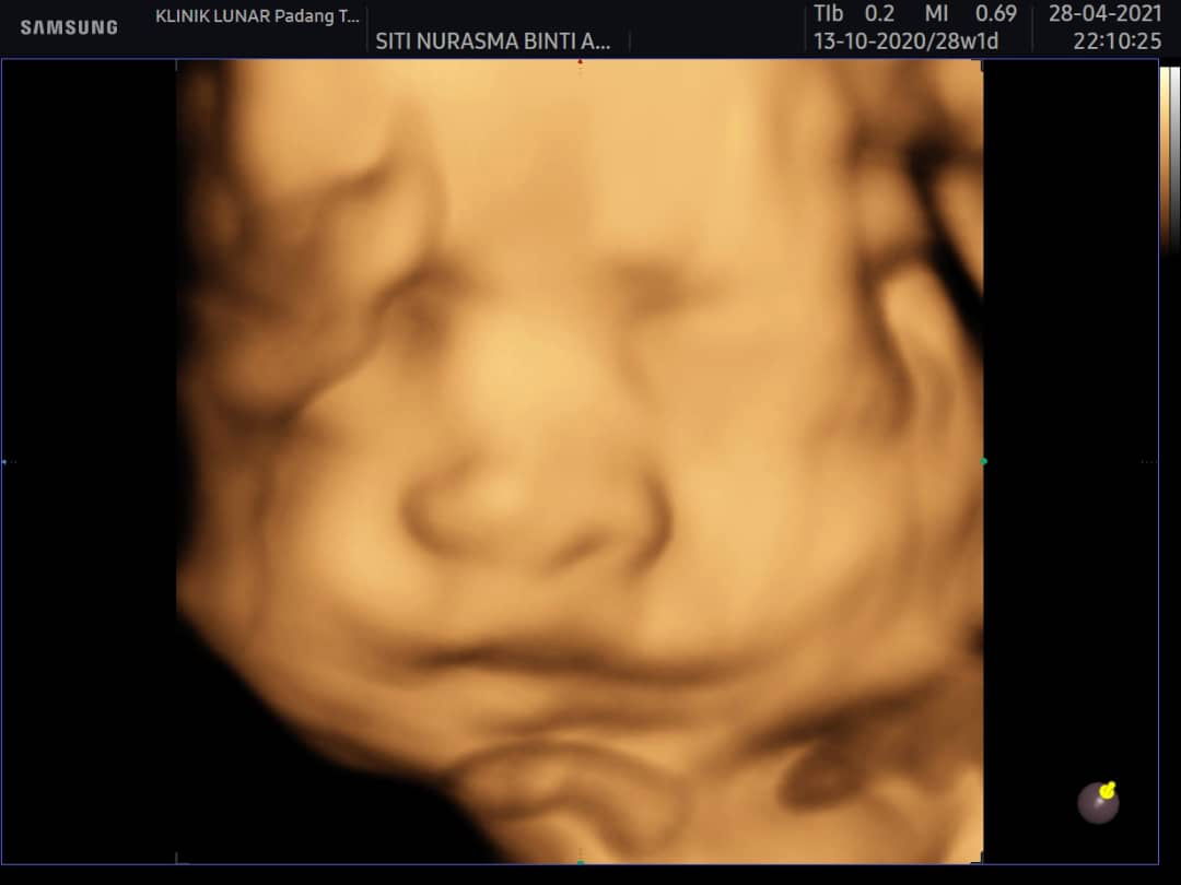 Baby A ? profile icon