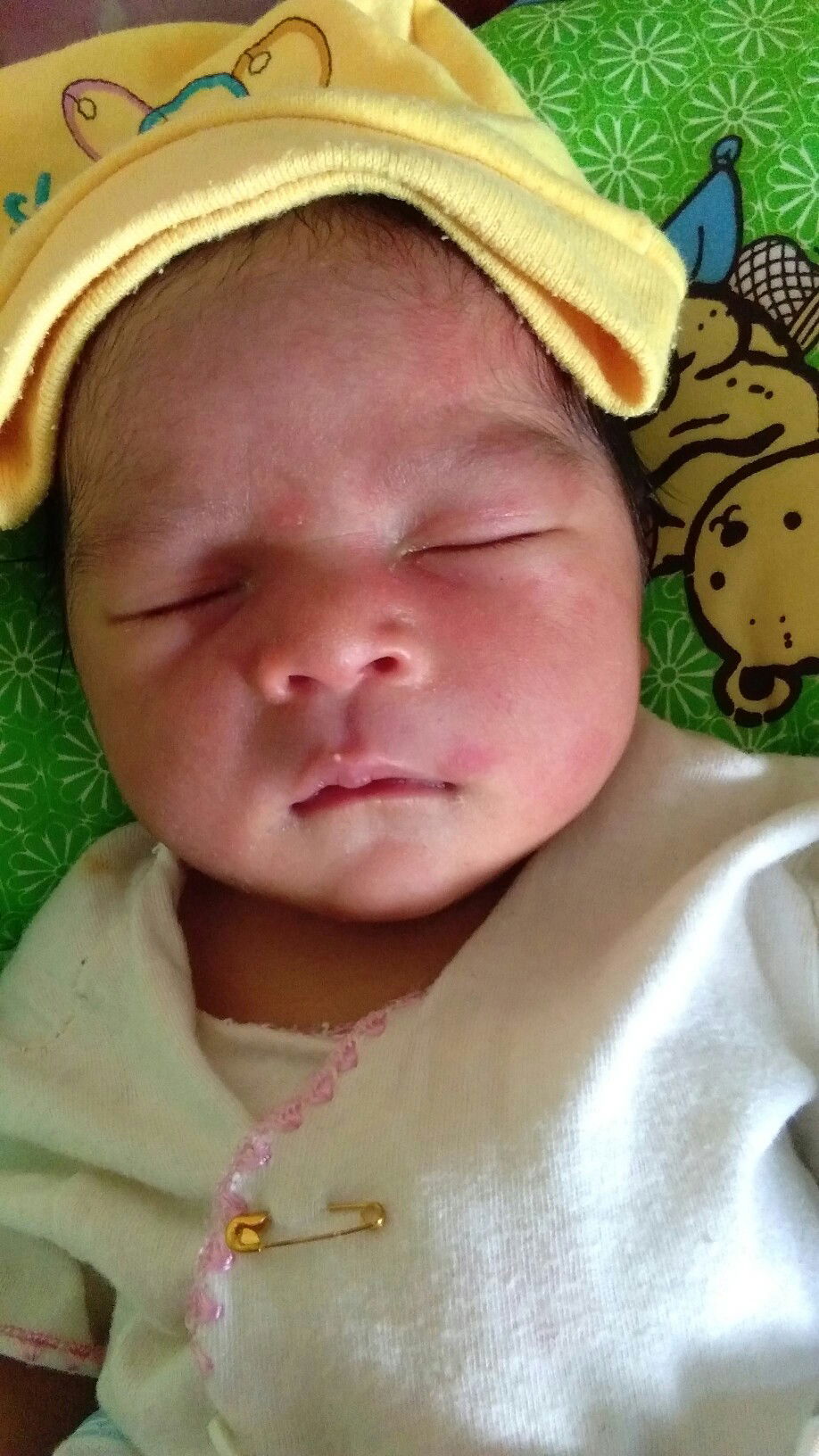 bayi muncul ruam merah