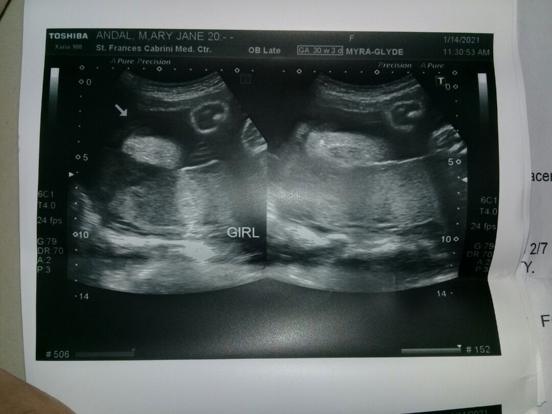 Mary jane Andal profile icon