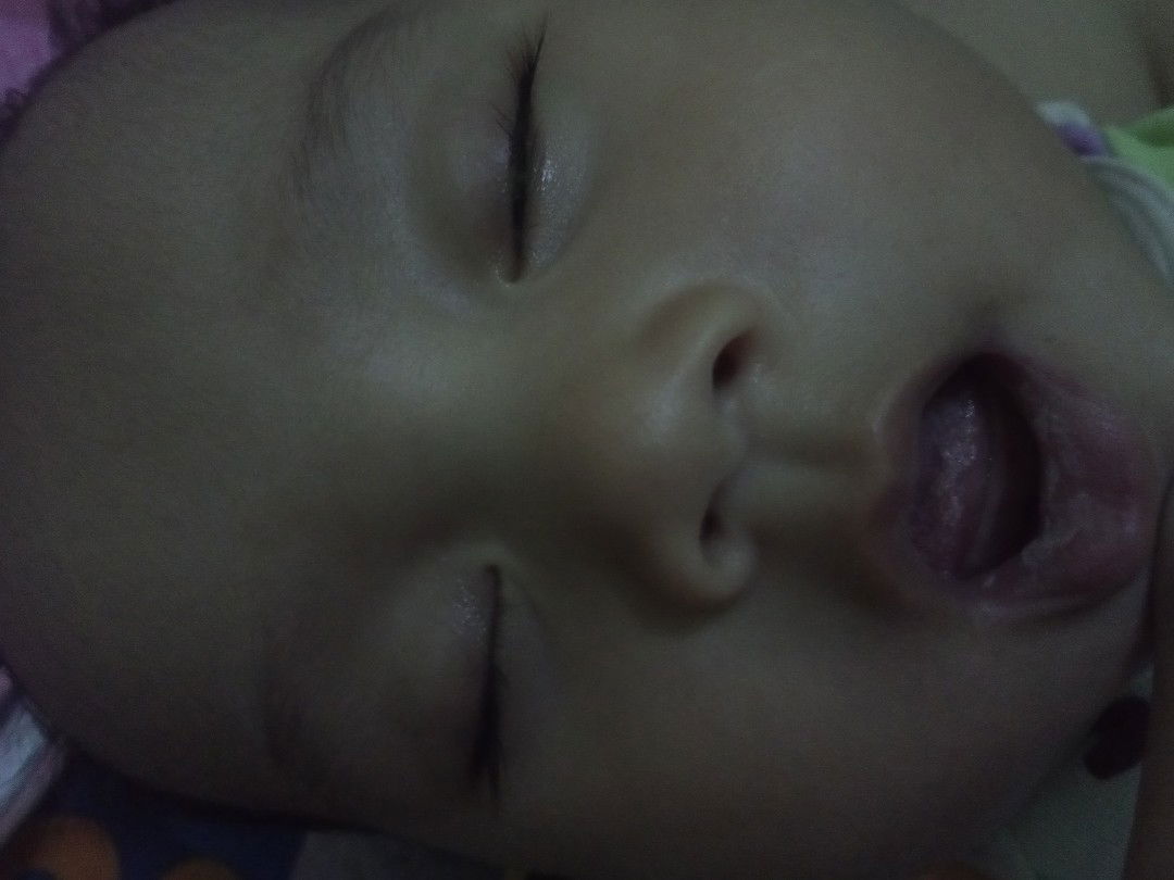 bibir bayi putih serta lidah