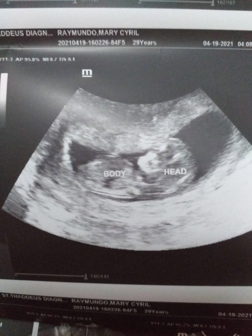 Cyril Raymundo profile icon