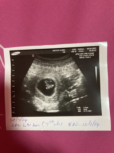 มีตัวน้องหรือยังค่ะแบบนี้