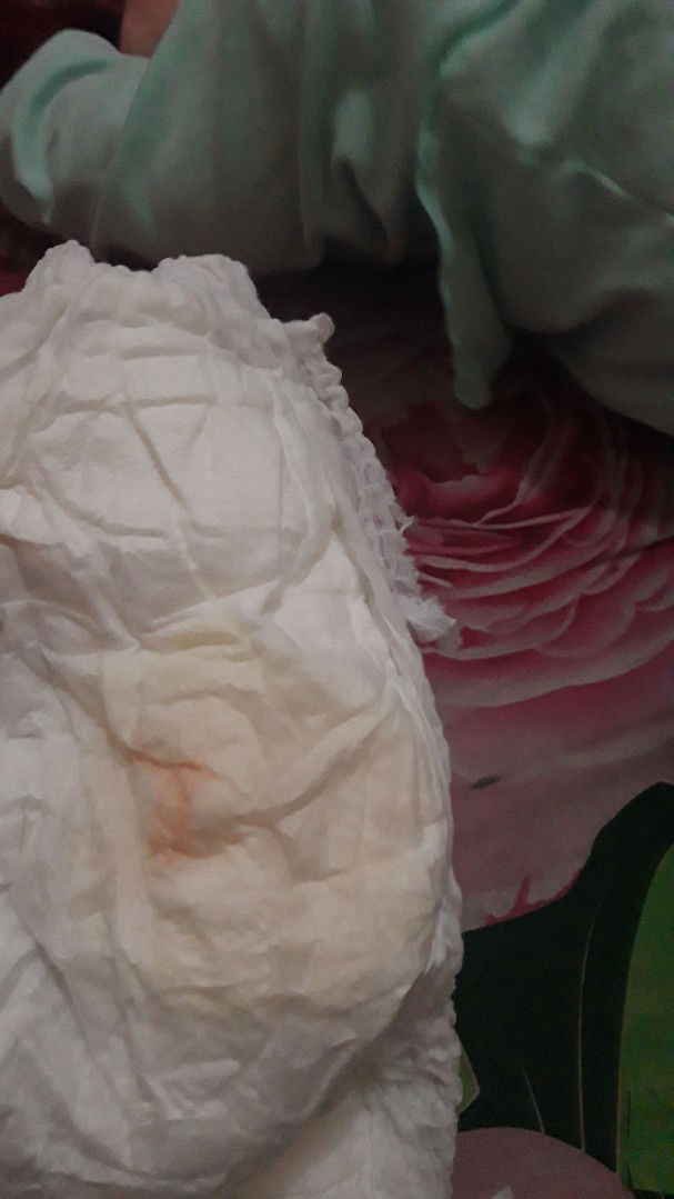 Warna Merah Muda Pada Urin Bayi Usia 4 Bulan