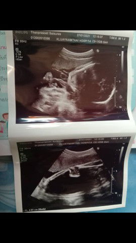 Saisuree nipattkung profile icon