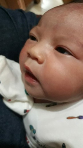 Welcome to the world