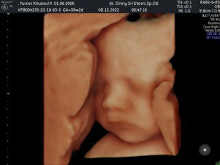 Yuniar Husnul profile icon