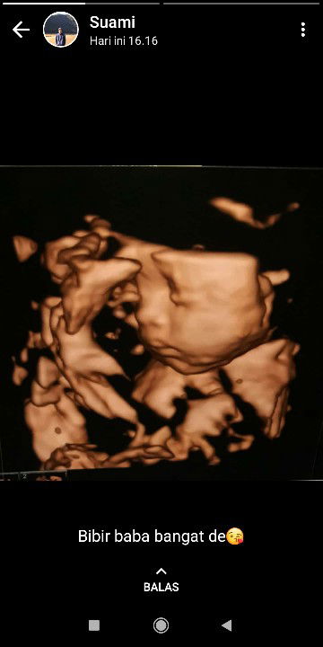 Della Ayu profile icon