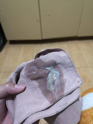 vaginal discharge