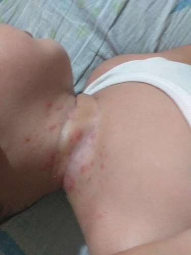 Ano po ba to?