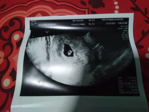 ขอคำแนะนำ