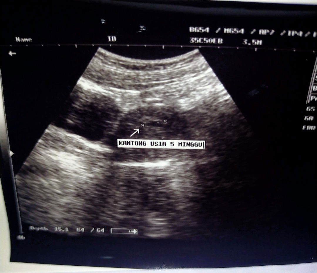 Septika Damayanti profile icon