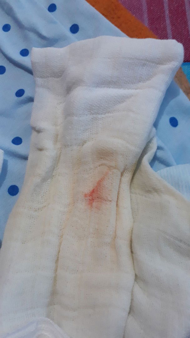 pipis ada sedikit darah