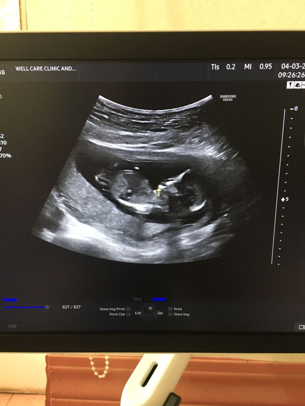 Lorraine Darping profile icon