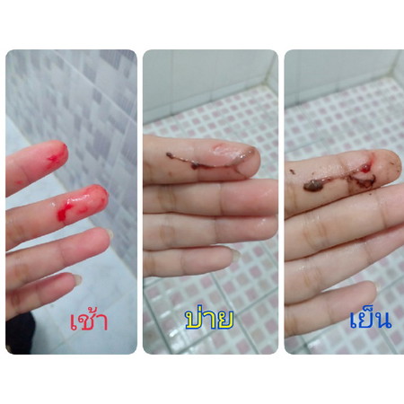 มีเลือดออกก่อนรอบเดือนจะมา ใครเป็นบ้างค่ะ