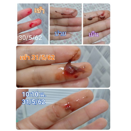 เลือดล้างหน้าเด็ก รึ ประจำเดือน ค่ะ