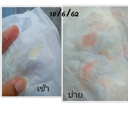 มาแบบงงๆอีก ป้าแดงจะมา 2 รอบเหรอ บ้านไหนเป็นแบบนี้บ้างค่ะ