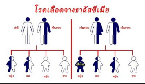 โรคธาลัสซีเมีย
