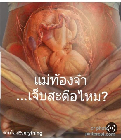 ทำไมคนท้องเจ็บสะดือ ‼️ ปกติมั้ย มีคำตอบ‼️