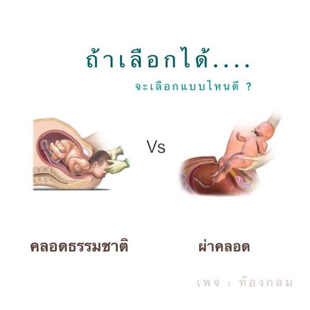 พอเริ่มท้องแก่ ก็เริ่มมีคำถามในหัวว่าจะคลอดแบบไหนดี ?
คลอดเอง หรือผ่าดีนะ.... ?