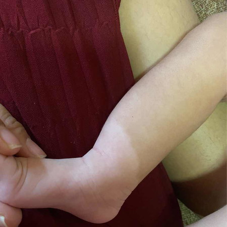 ขาสองสี