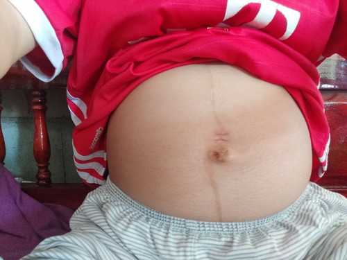 ท้องแบบนี้ ผู้หญิงหรือผู้ชายคะ