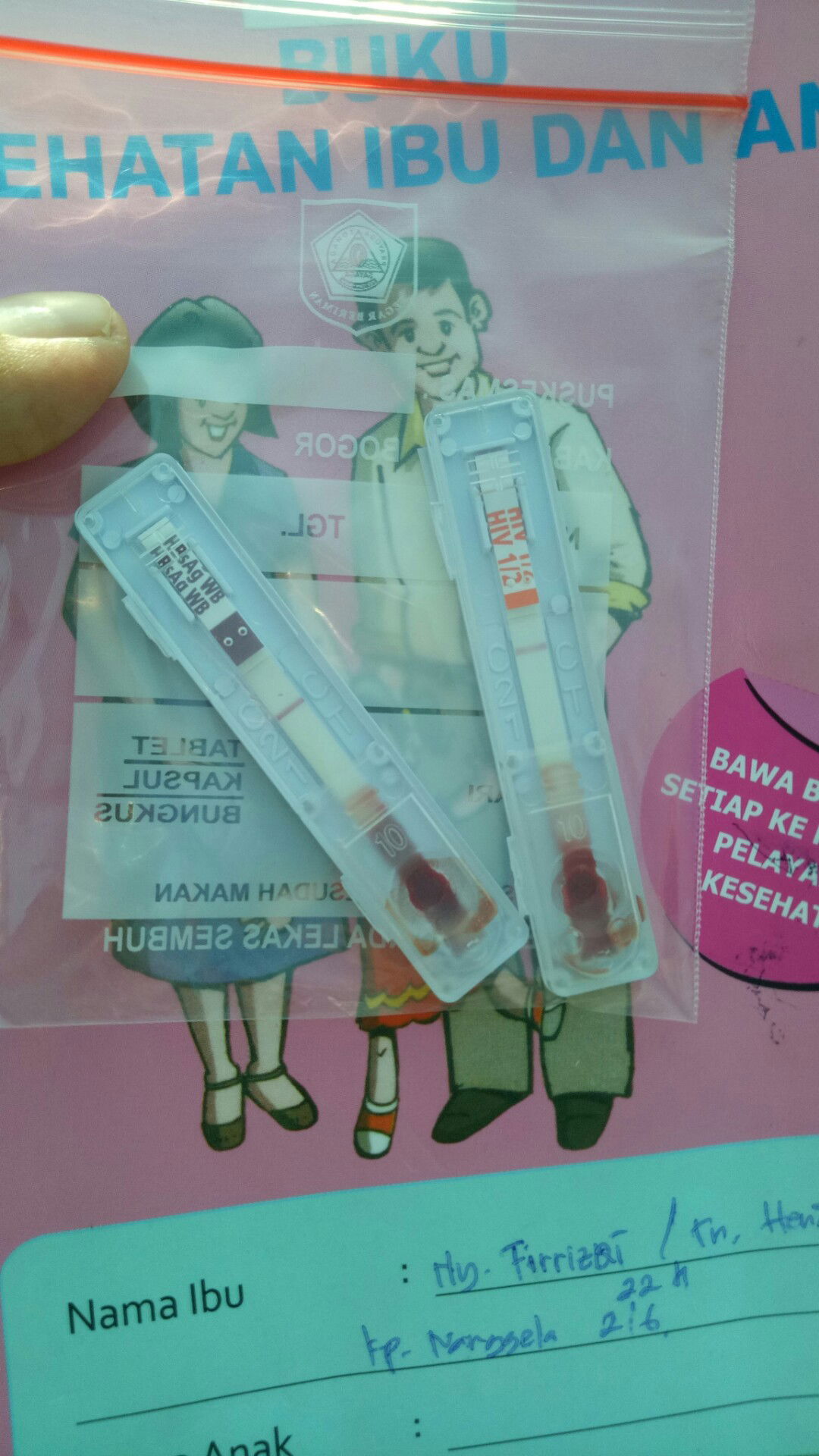 CEK lab HB,  HIV dan HbsAg