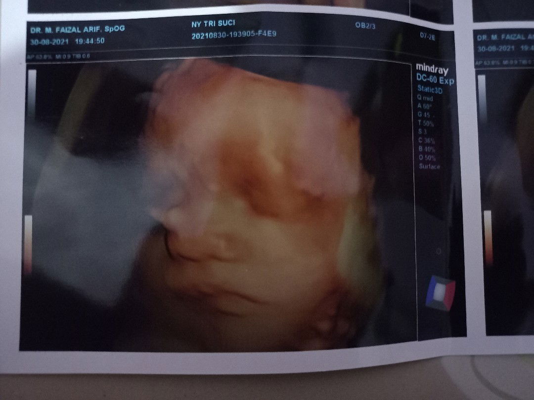 Tri suci Wulandari profile icon