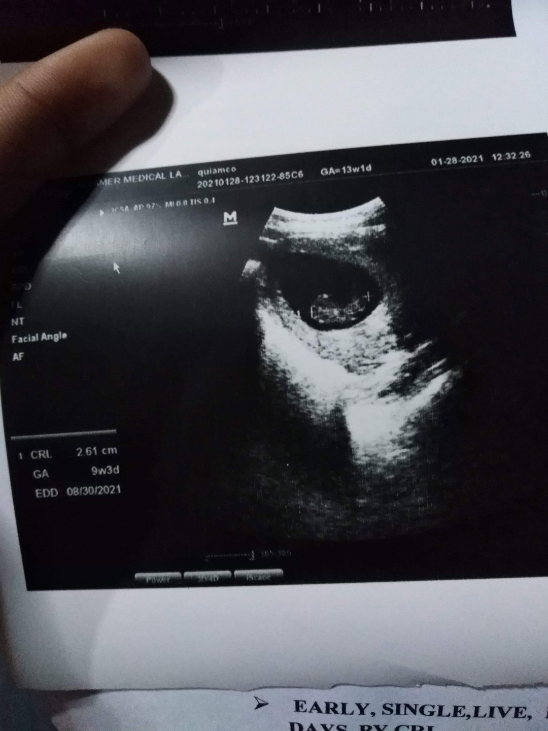 Marieberth Lauron profile icon