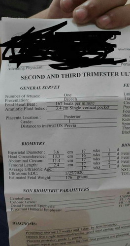 ultrasound results