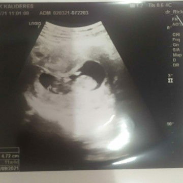 Zhenly Wajar profile icon