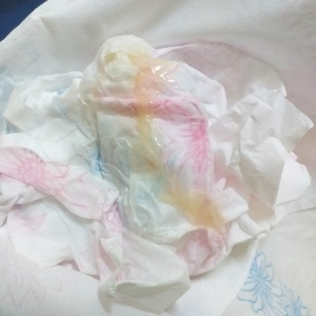 กังวน และ เครียดค่ะ