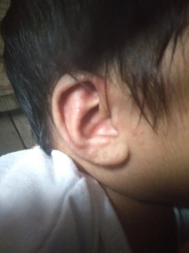 ears