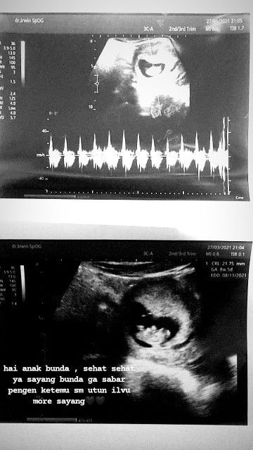 afshana helmalia putri profile icon