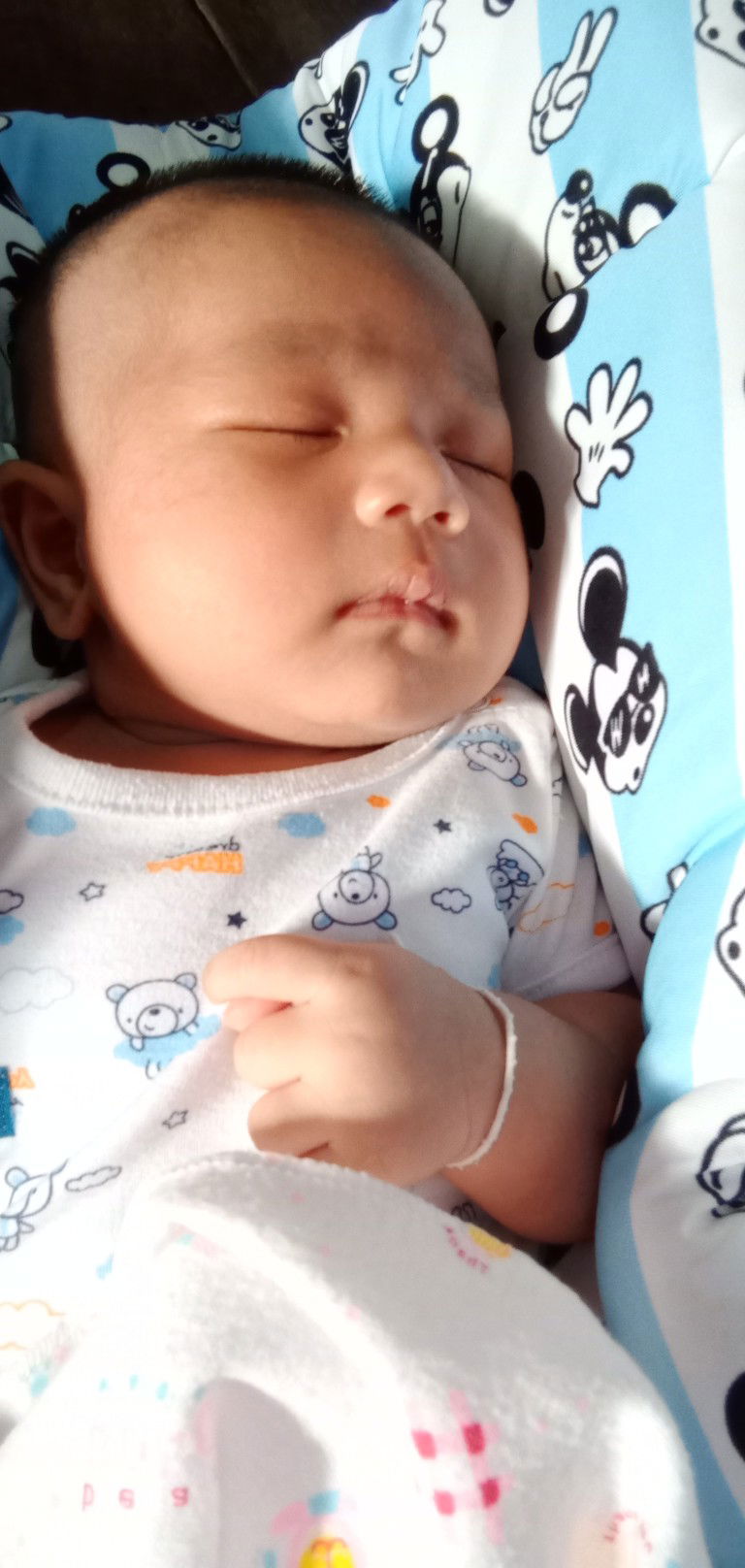 วิธีรักษากรากเกลื้อนน้ำนม