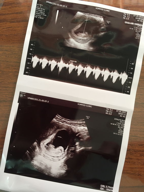 10w3d รกเกาะต่ำ