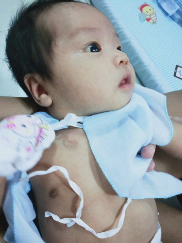 ขอคำแนะนำอาการ overfeeding ทารก