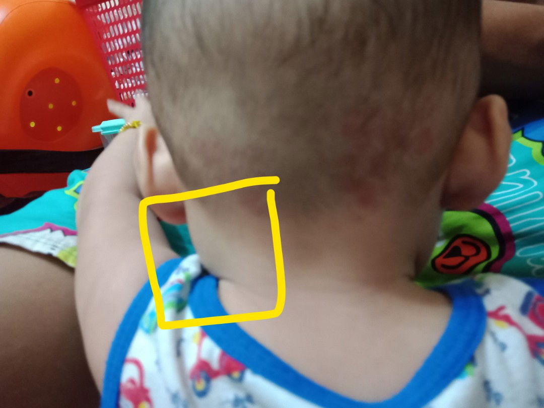 ลูกเป็นไข้