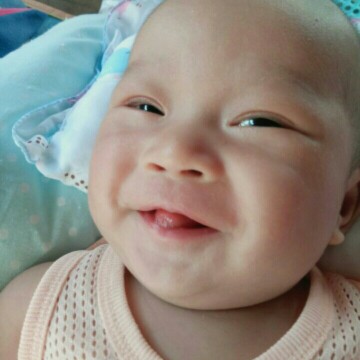 น้องตาเหลือง
