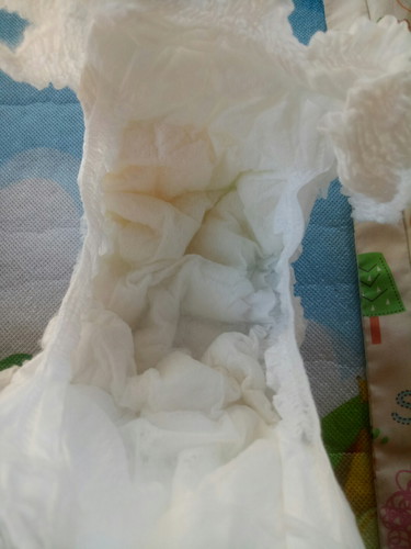 มีบ้านไหนเป็นเหมือนกันบ้างคะ?