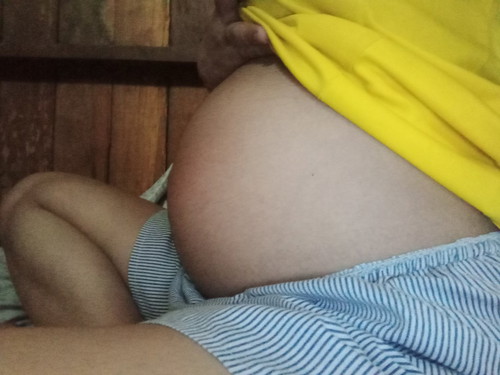 ขอดูท้องเเม่ๆคลอดมีนาหน่อย