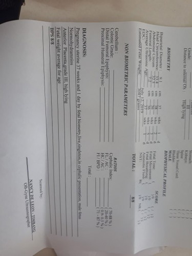 Is it a Good Result?