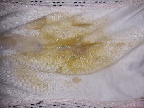 please help!!! pasintabi sa mga kumakain dahil medyo maselan eto