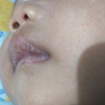 bibir kering pecah pecah