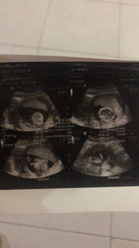 Rindha meitanty Putri profile icon